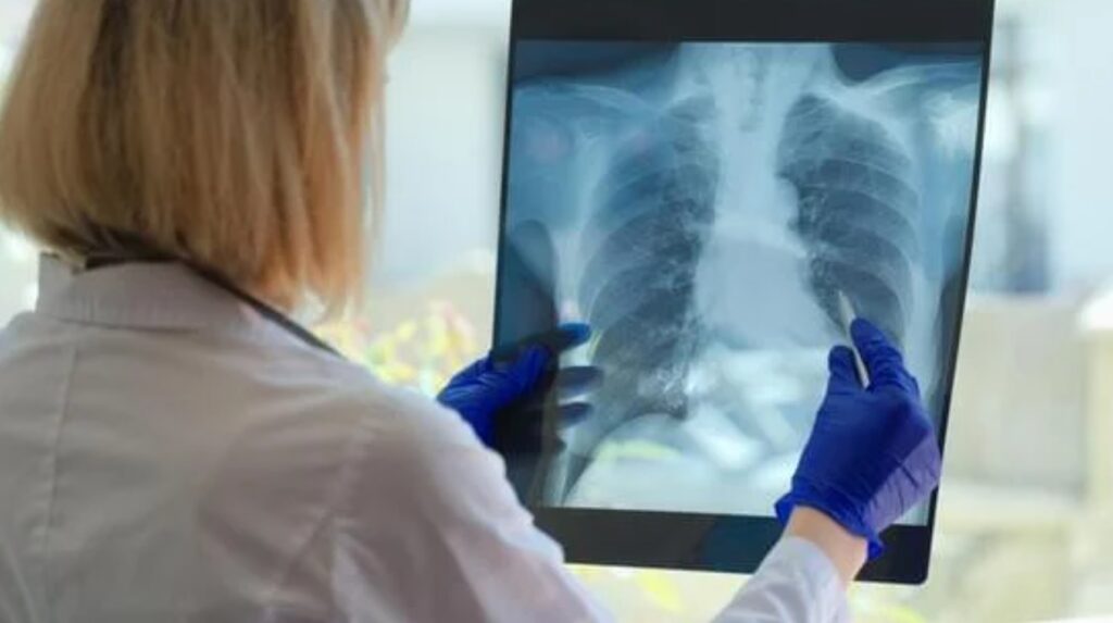 Angie Daniels feature on young cancer patients